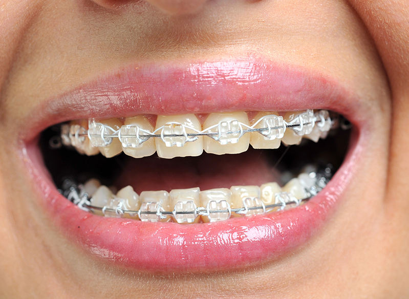 矯正歯科・小児矯正歯科